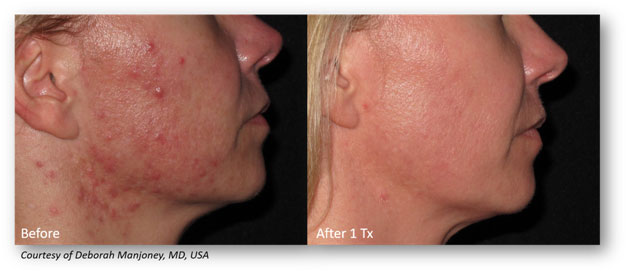 Skin-Blemishes-2